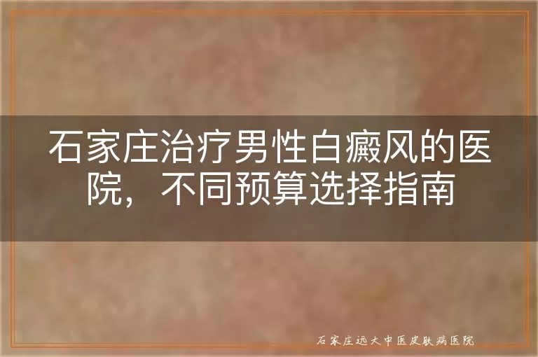 石家庄治疗男性白癜风的医院，不同预算选择指南
