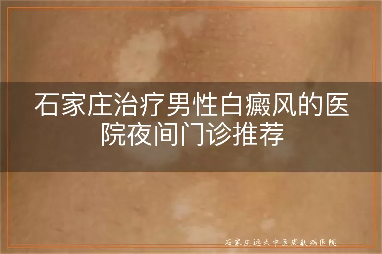 石家庄治疗男性白癜风的医院夜间门诊推荐