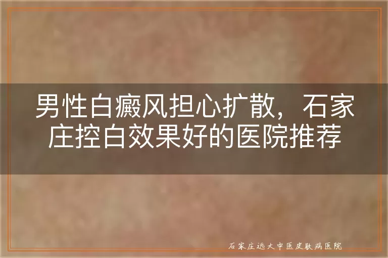 男性白癜风担心扩散，石家庄控白效果好的医院推荐