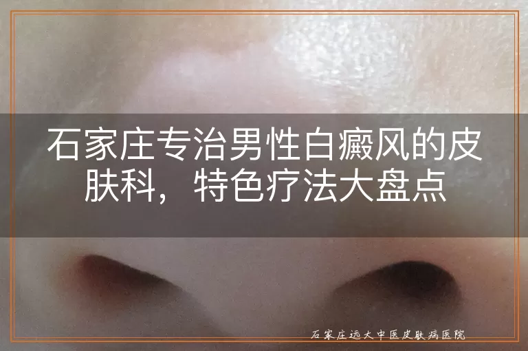石家庄专治男性白癜风的皮肤科，特色疗法大盘点