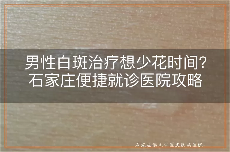 男性白斑治疗想少花时间？石家庄便捷就诊医院攻略