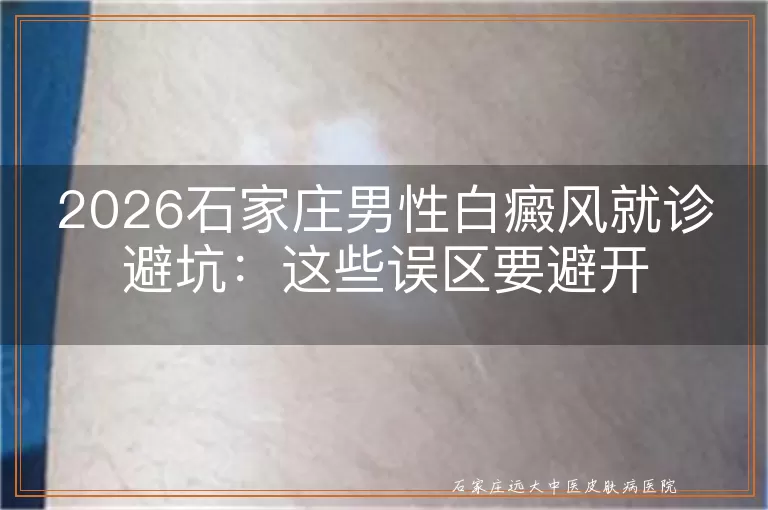 2026石家庄男性白癜风就诊避坑：这些误区要避开