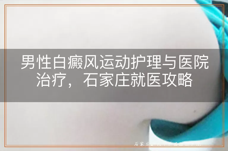 男性白癜风运动护理与医院治疗，石家庄就医攻略