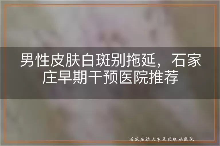 男性皮肤白斑别拖延，石家庄早期干预医院推荐