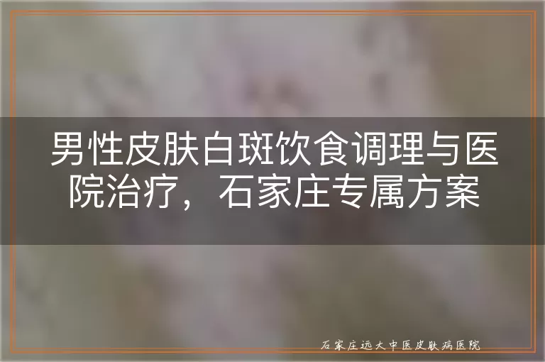 男性皮肤白斑饮食调理与医院治疗，石家庄专属方案