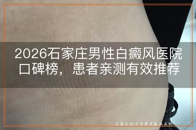 2026石家庄男性白癜风医院口碑榜，患者亲测有效推荐