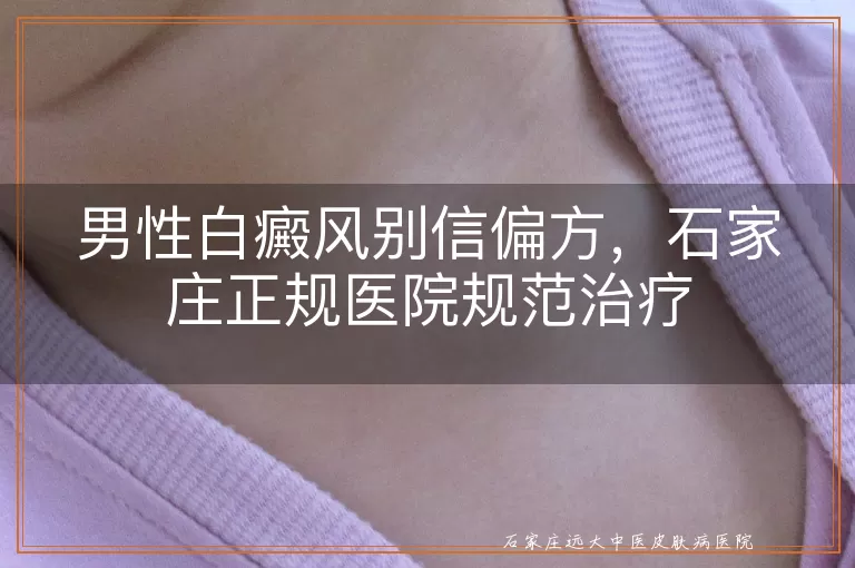 男性白癜风别信偏方，石家庄正规医院规范治疗