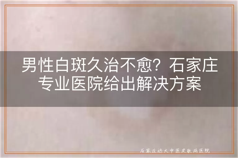 男性白斑久治不愈?石家庄专业医院给出解决方案