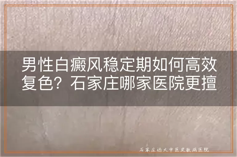 男性白癜风稳定期如何高效复色？石家庄哪家医院更擅长