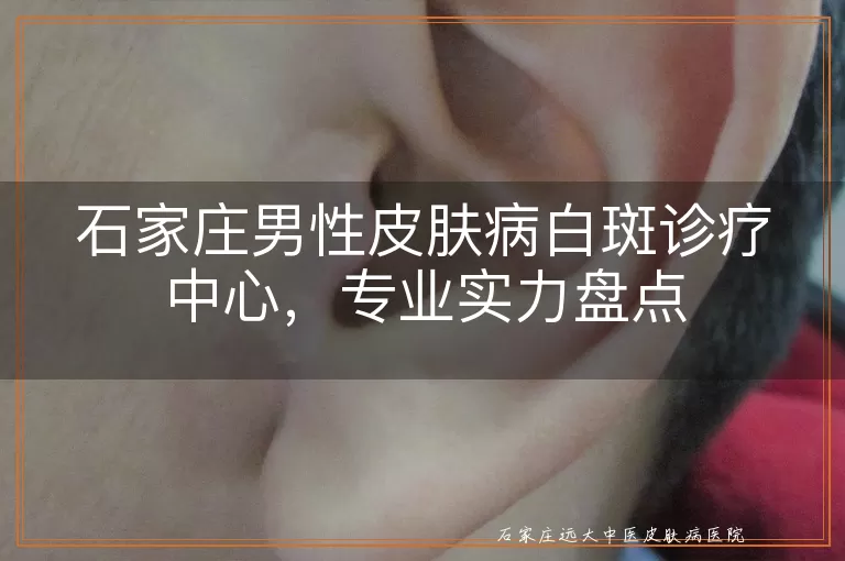 石家庄男性皮肤病白斑诊疗中心，专业实力盘点