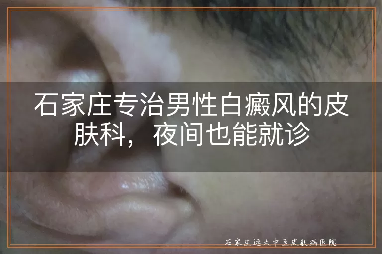 石家庄专治男性白癜风的皮肤科，夜间也能就诊