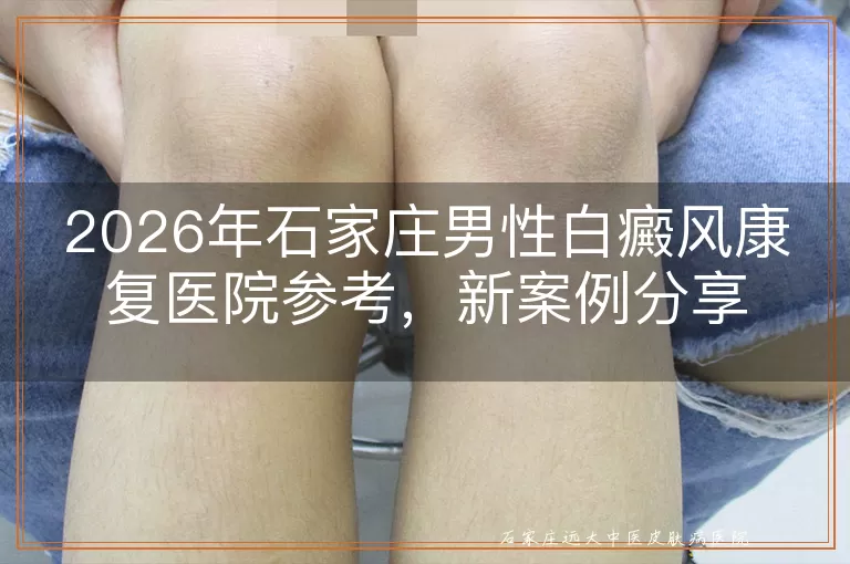 2026年石家庄男性白癜风康复医院参考，新案例分享