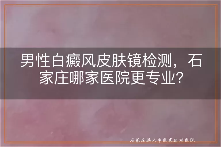 男性白癜风皮肤镜检测，石家庄哪家医院更专业？