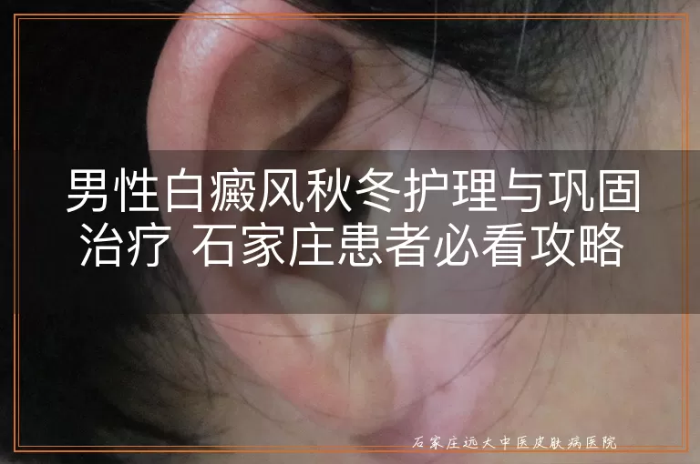 男性白癜风秋冬护理与巩固治疗 石家庄患者必看攻略