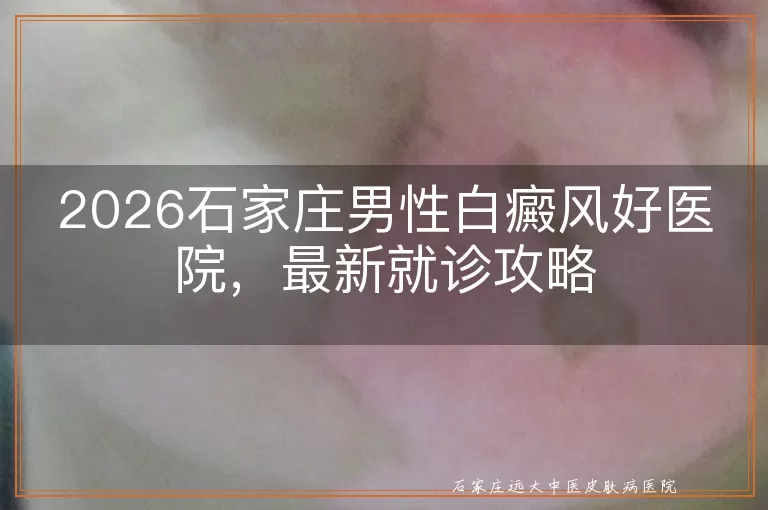 2026石家庄男性白癜风好医院，最新就诊攻略