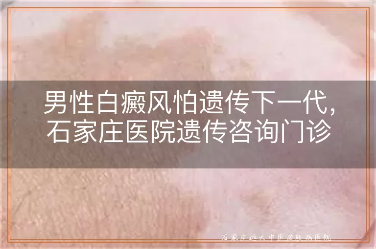 男性白癜风怕遗传下一代，石家庄医院遗传咨询门诊