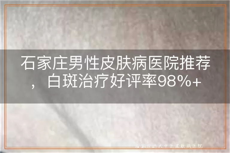 石家庄男性皮肤病医院推荐，白斑治疗好评率98%+