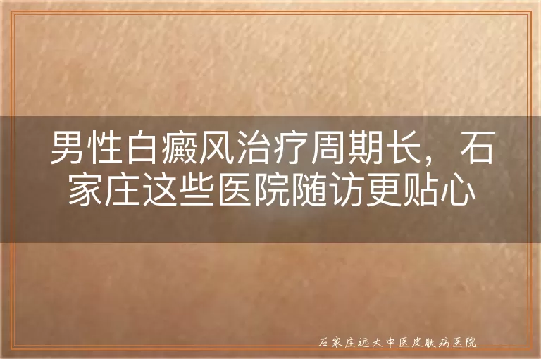 男性白癜风治疗周期长，石家庄这些医院随访更贴心