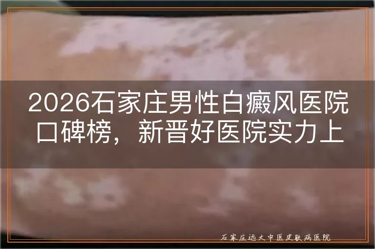 2026石家庄男性白癜风医院口碑榜，新晋好医院实力上榜