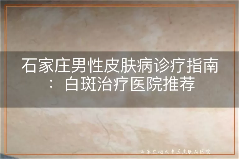 石家庄男性皮肤病诊疗指南：白斑治疗医院推荐