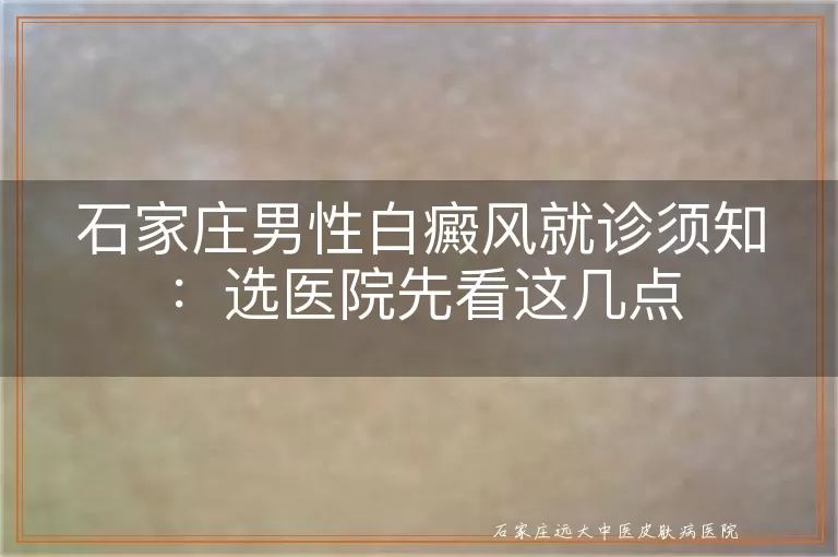 石家庄男性白癜风就诊须知：选医院先看这几点