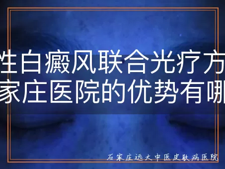 男性白癜风联合光疗方案，石家庄医院的优势有哪些