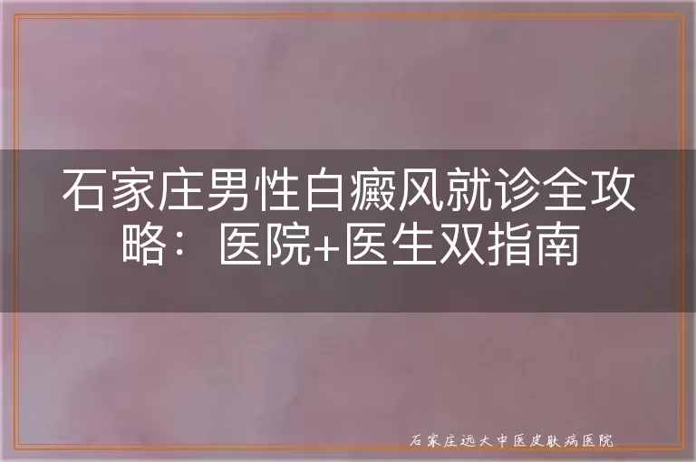 石家庄男性白癜风就诊全攻略:医院+医生双指南