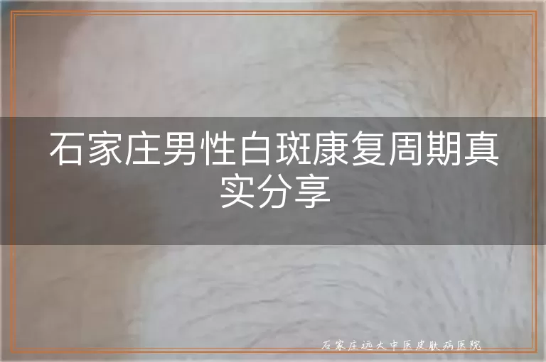石家庄男性白斑康复周期真实分享
