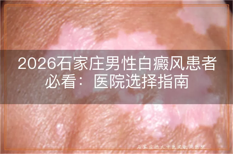 2026石家庄男性白癜风患者必看：医院选择指南