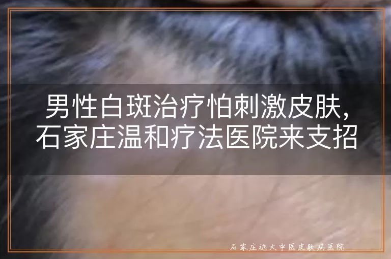 男性白斑治疗怕刺激皮肤，石家庄温和疗法医院来支招