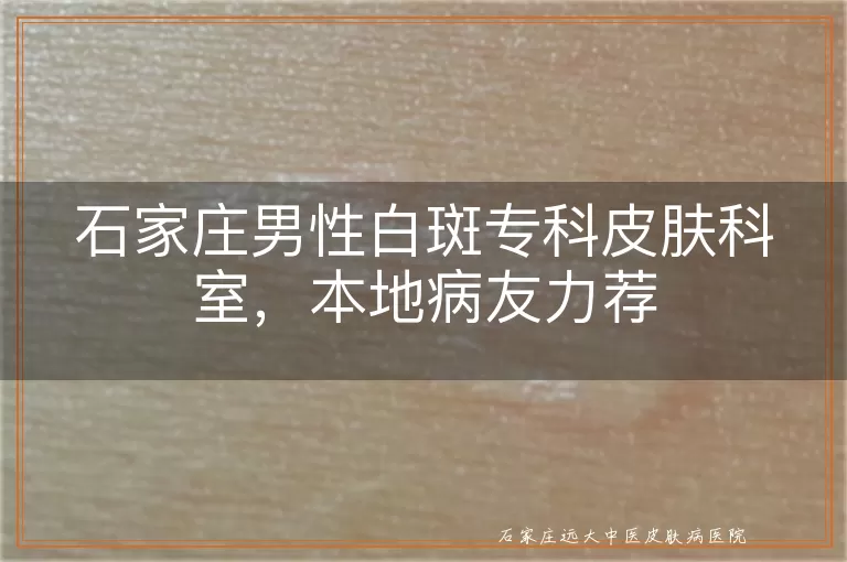 石家庄男性白斑专科皮肤科室，本地病友力荐