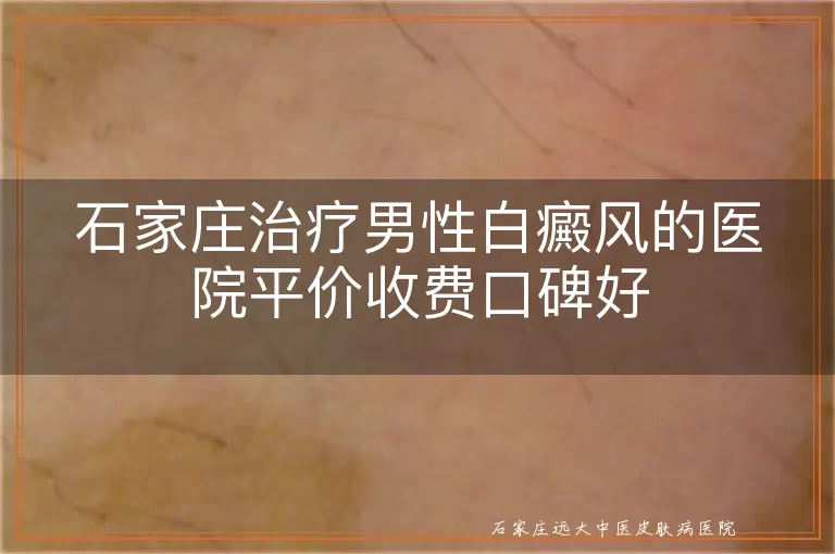 石家庄治疗男性白癜风的医院平价收费口碑好