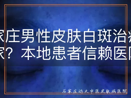 石家庄男性皮肤白斑治疗去哪家？本地患者信赖医院盘点