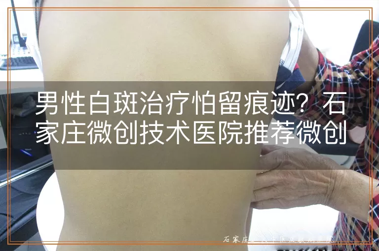 男性白斑治疗怕留痕迹？石家庄微创技术医院推荐微创不留疤方案