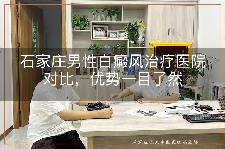 石家庄男性白癜风治疗医院对比,优势一目了然