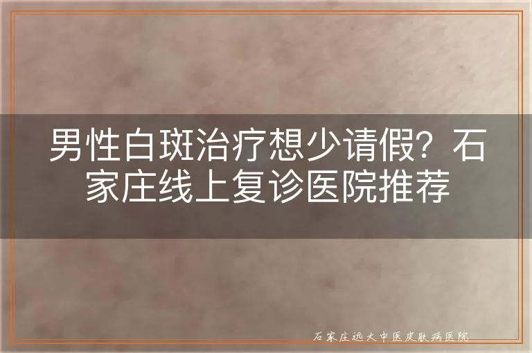 男性白斑治疗想少请假?石家庄线上复诊医院推荐