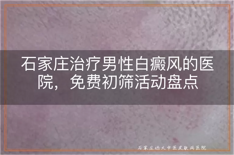 石家庄治疗男性白癜风的医院,免费初筛活动盘点