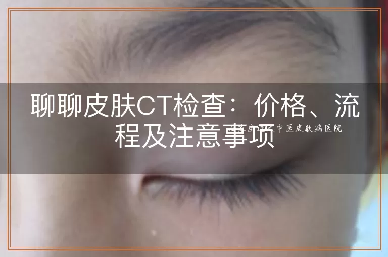 聊聊皮肤CT检查：价格、流程及注意事项