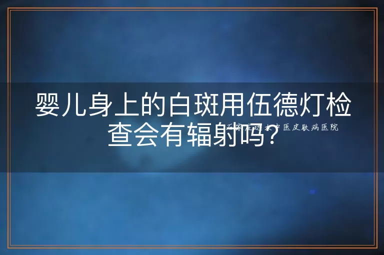婴儿身上的白斑用伍德灯检查会有辐射吗？