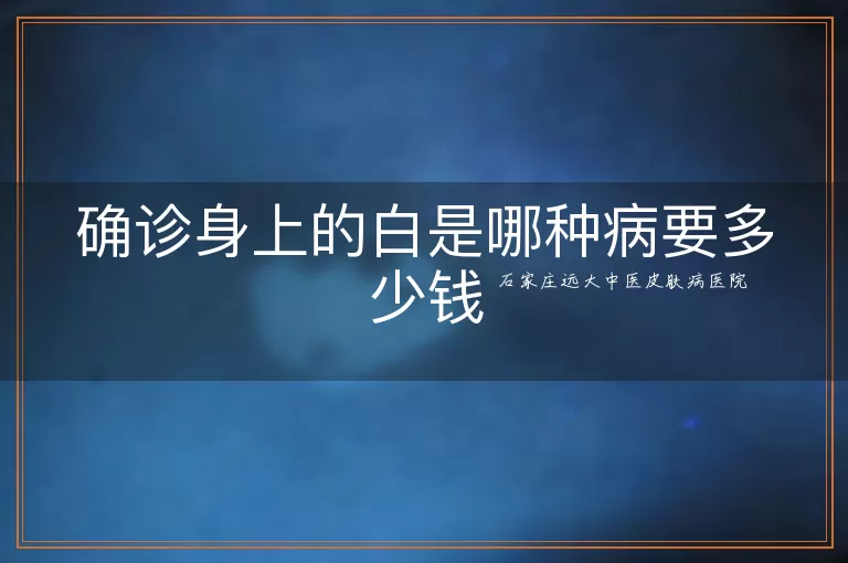 确诊身上的白是哪种病要多少钱