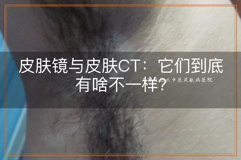 皮肤镜与皮肤CT：它们到底有啥不一样？