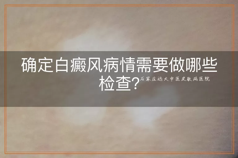 确定白癜风病情需要做哪些检查？