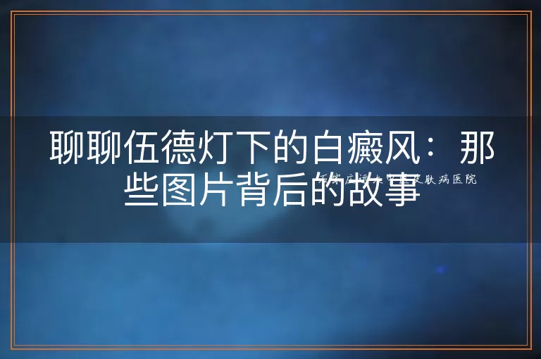 聊聊伍德灯下的白癜风：那些图片背后的故事