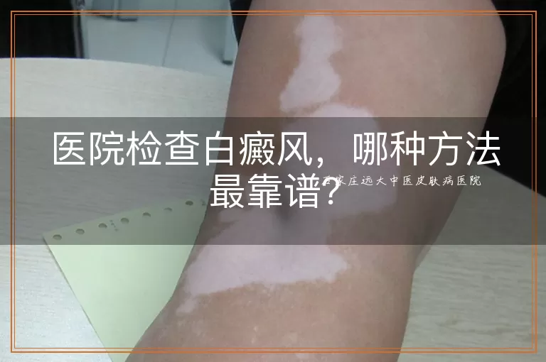 医院检查白癜风，哪种方法最靠谱？