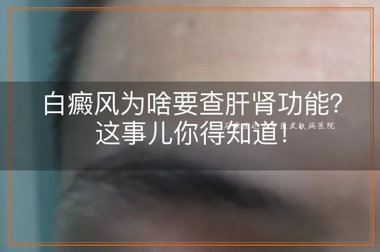 白癜风为啥要查肝肾功能？这事儿你得知道！