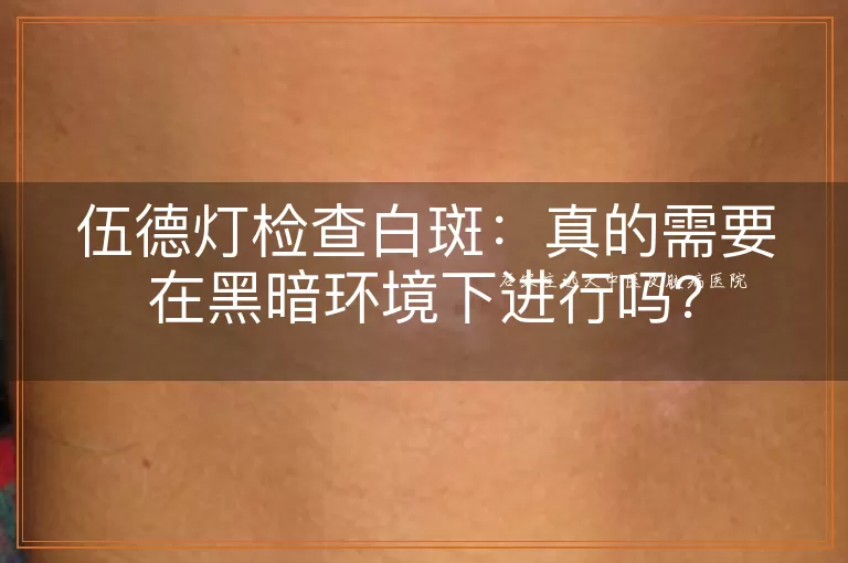 伍德灯检查白斑：真的需要在黑暗环境下进行吗？