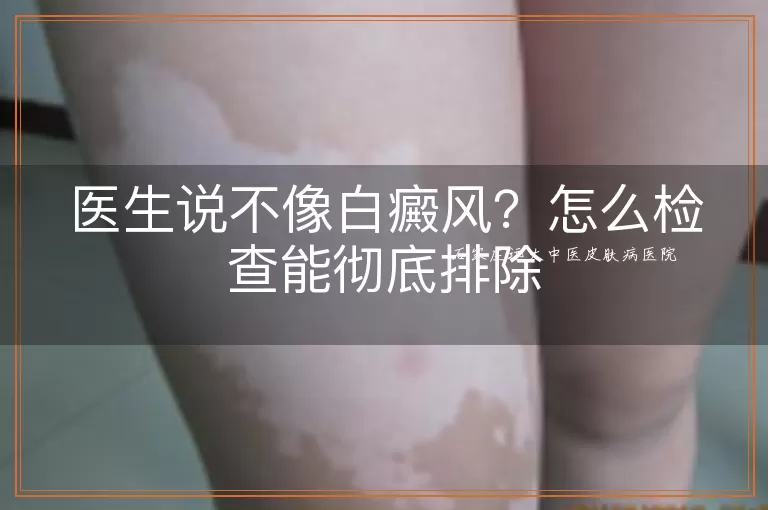 医生说不像白癜风？怎么检查能彻底排除