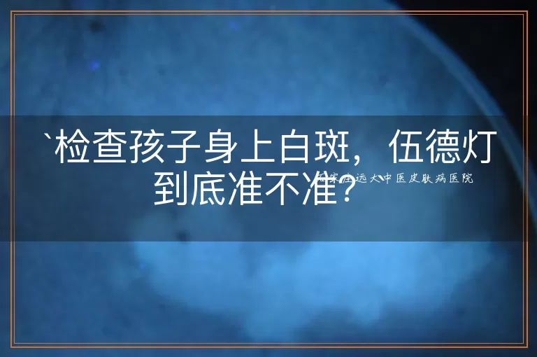 检查孩子身上白斑，伍德灯到底准不准？