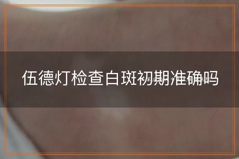 伍德灯检查白斑初期准确吗
