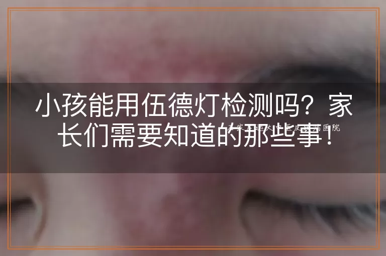 小孩能用伍德灯检测吗？家长们需要知道的那些事！